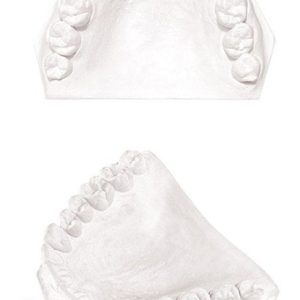 GARRECO Dental Plaster 25lb or 50lb, ALL TYPES