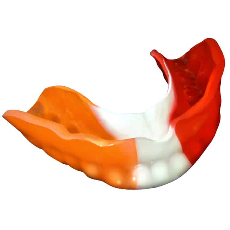 KEYSTONE Pro-Form Mouthguard Tri-Color Laminates All Colors